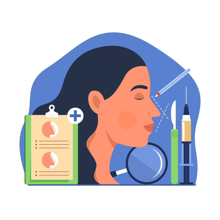 rhinoplasty