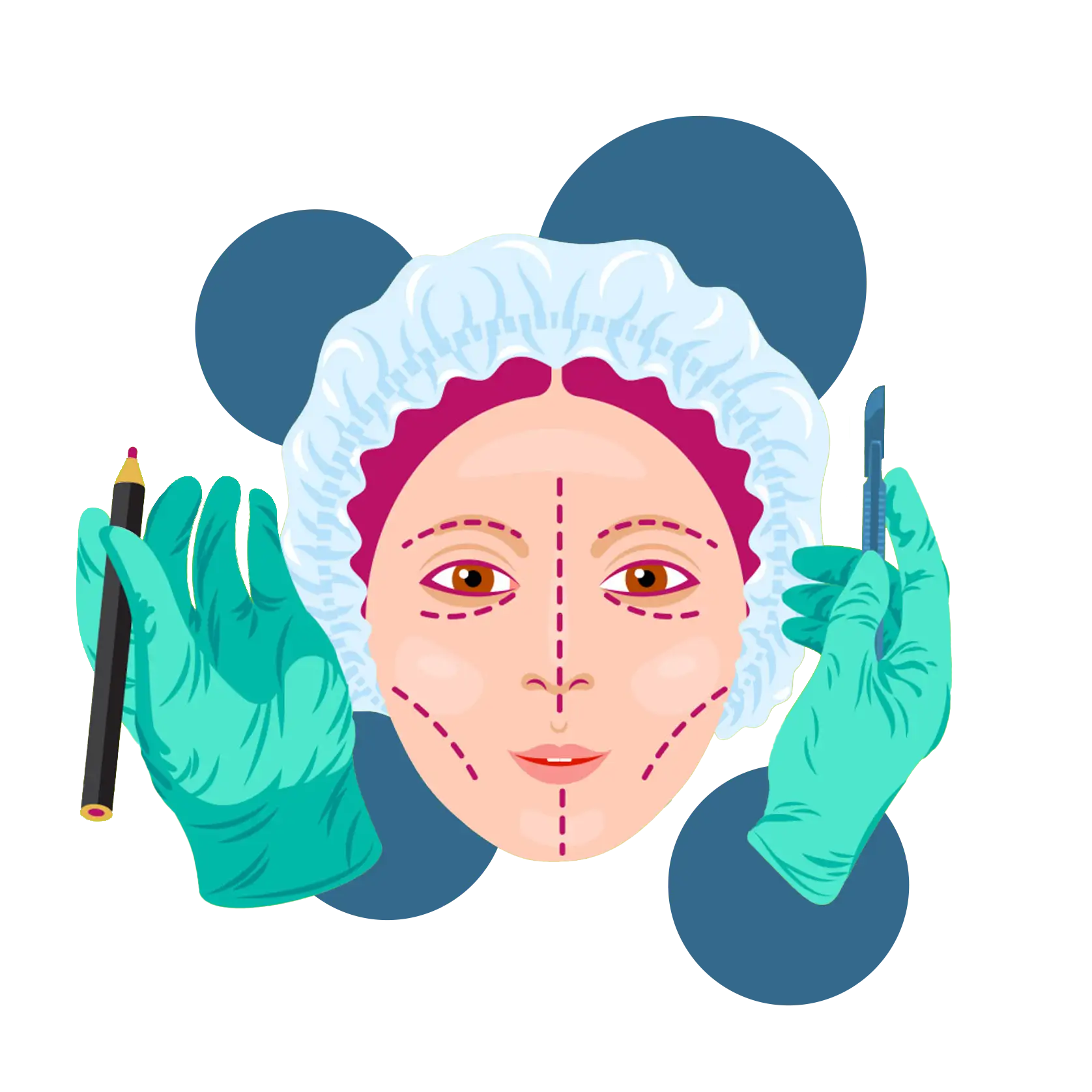 Facelift surgery