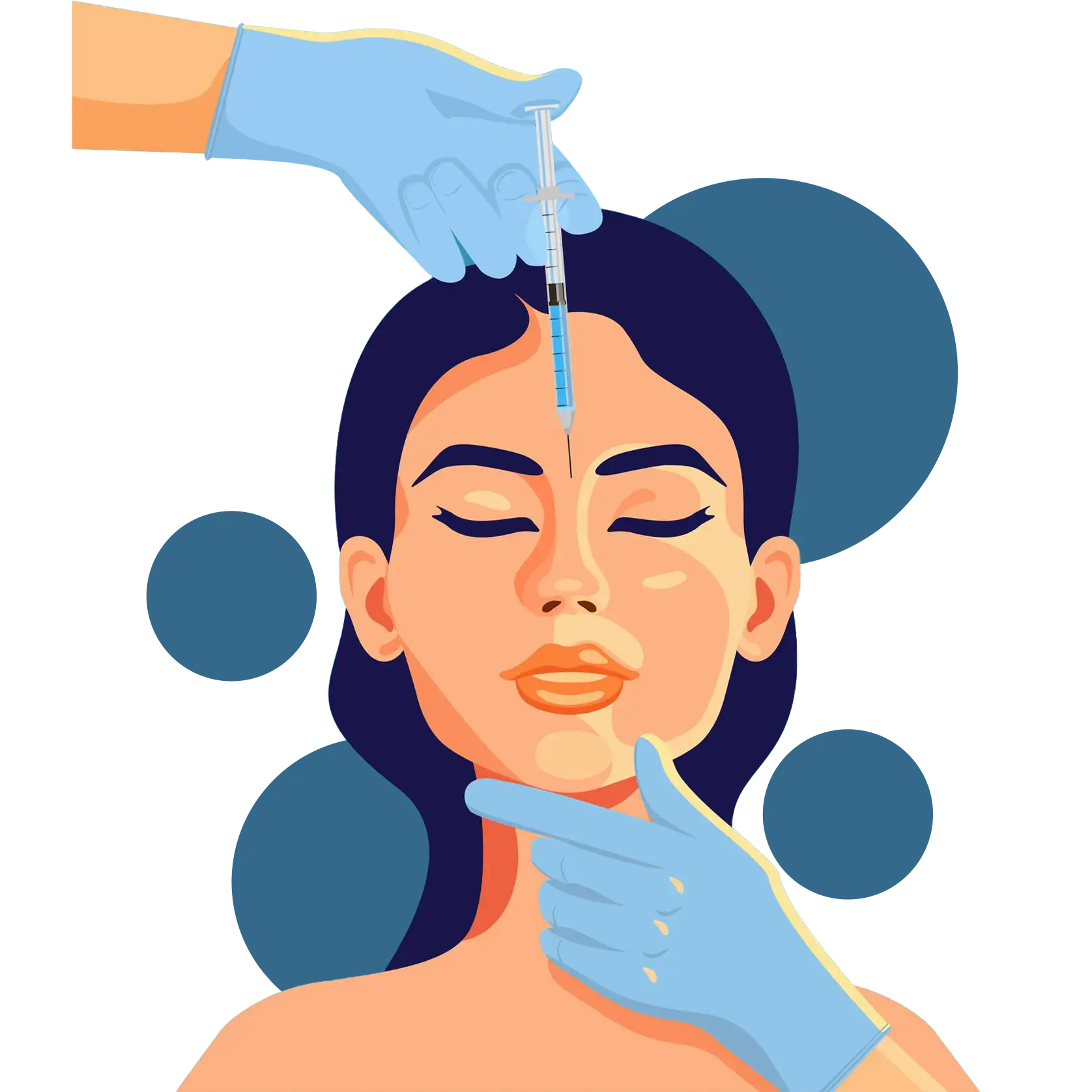 Facelift surgery