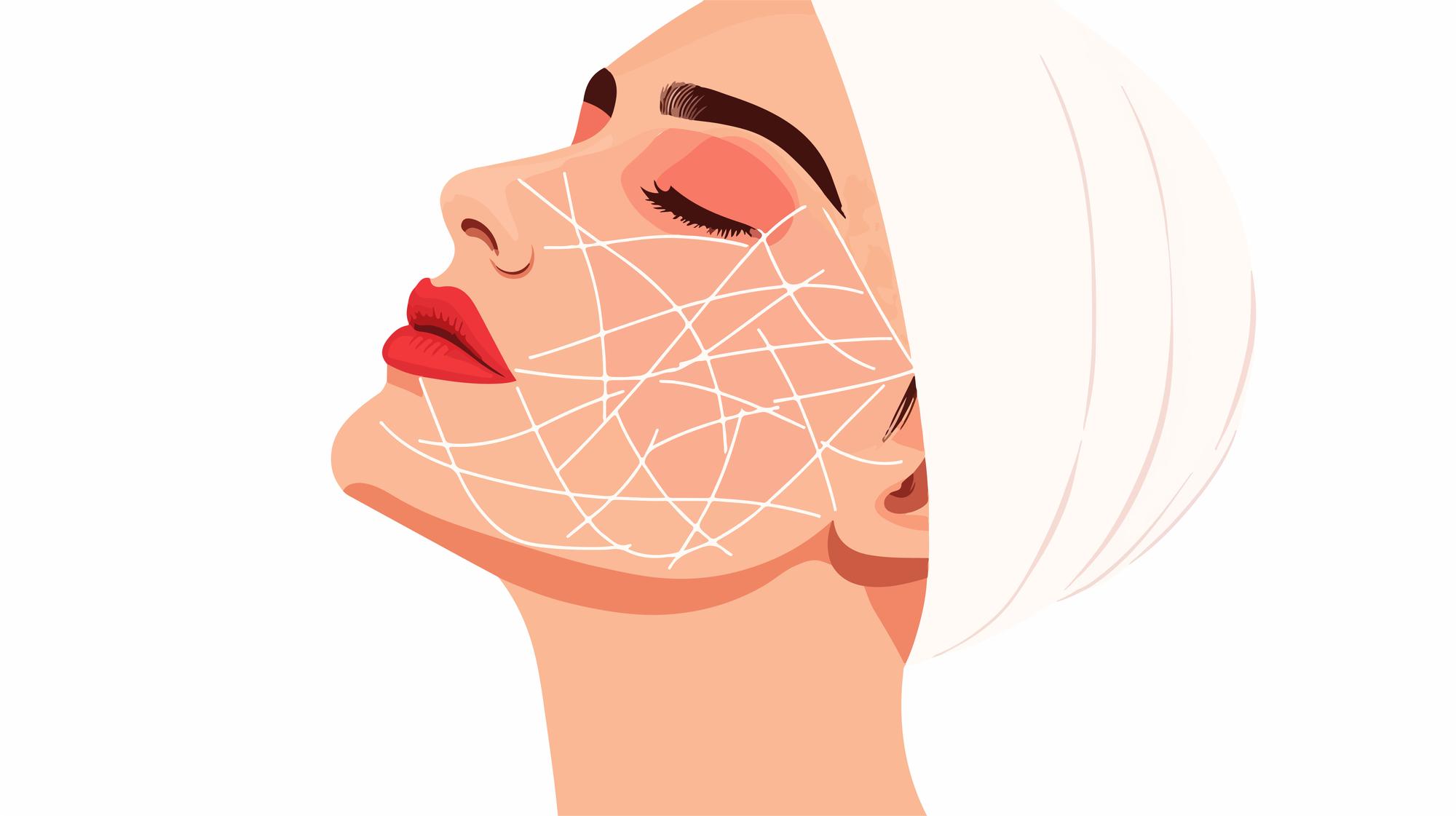 face lift 1