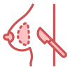 Breast Surgery Breast Surgery